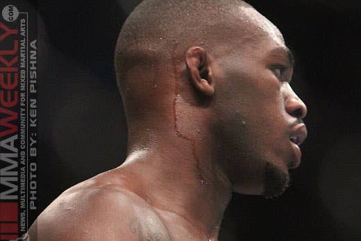 Jon Jones