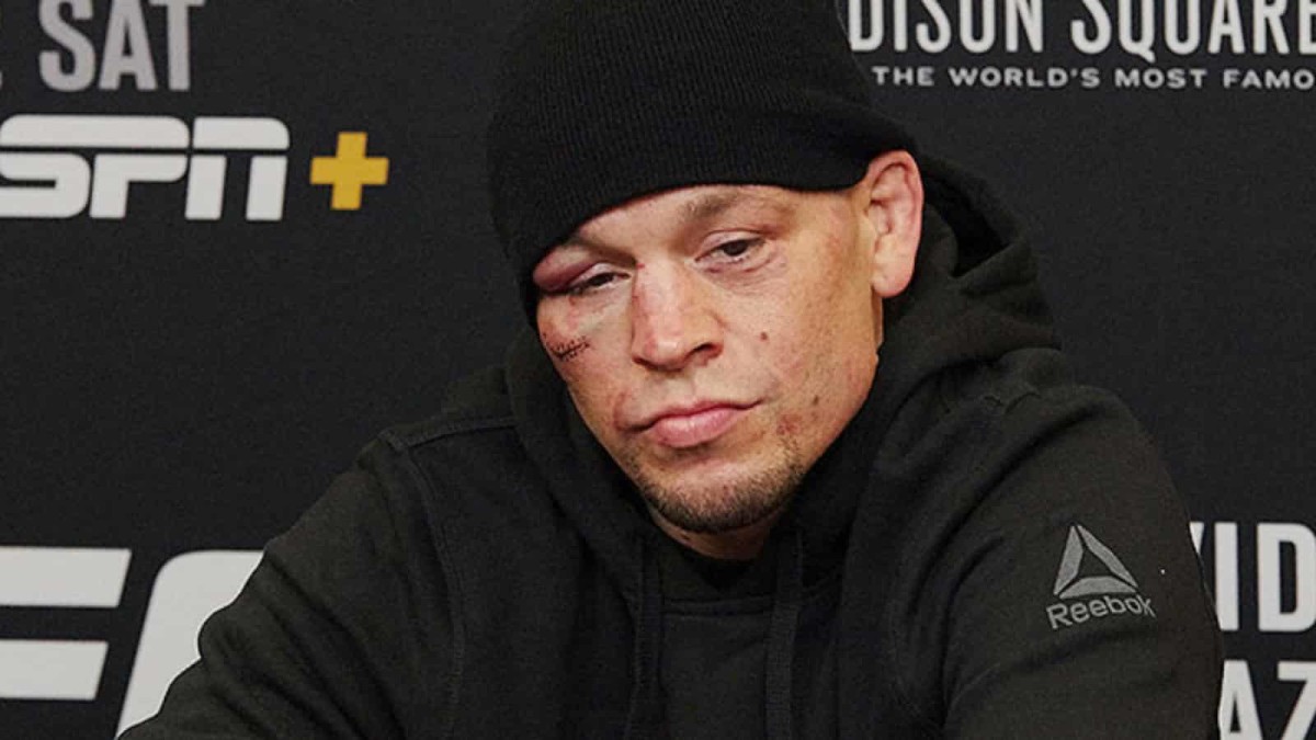 Nate Diaz celebrates Jorge Masvidal win with a joint backstage | VIDEO