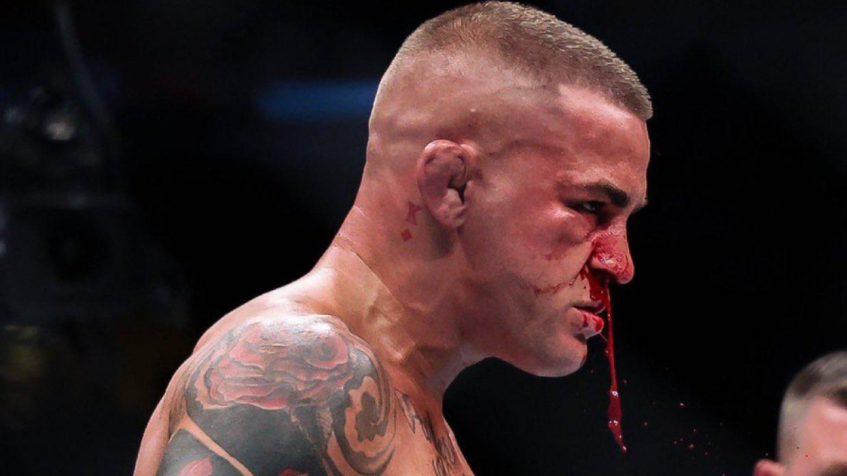 Dustin Poirier reveals several gruesome injuries post-UFC 302