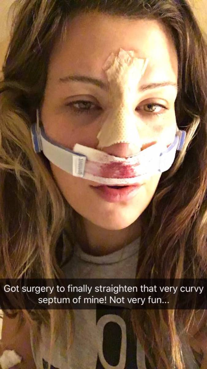 miesha tate broken nose