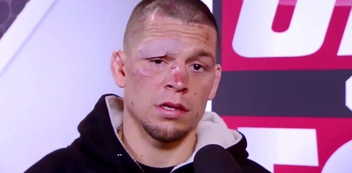 Nate Diaz Explains Issues 'I Was Outta Shape, (but) I Had to Get Paid' (Video)